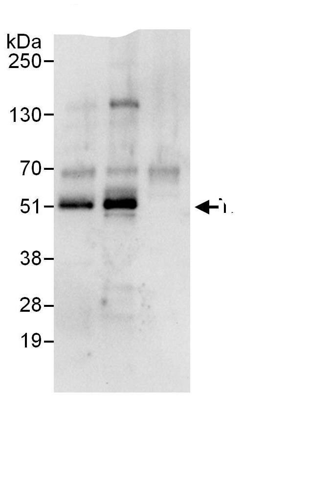 TXNIP Antibody