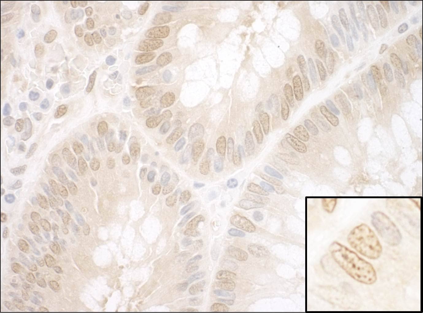 NPAT Antibody