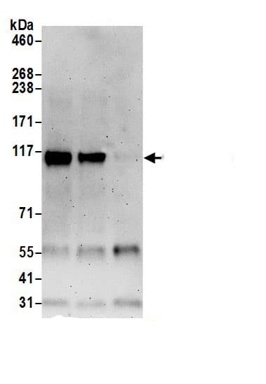 SKT Antibody