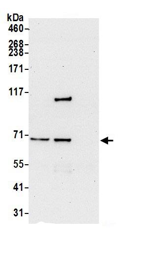 ATP6V1A Antibody