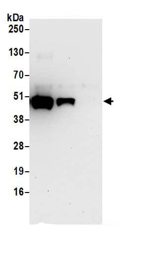 ADE2 Antibody