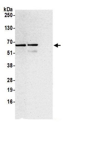 YARS Antibody