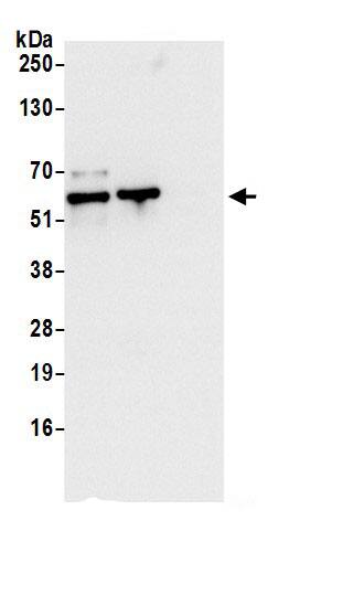 CCDC47 Antibody