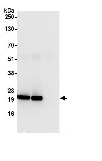 ATP5O Antibody