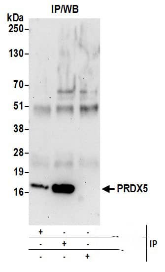 Peroxiredoxin 5 Antibody