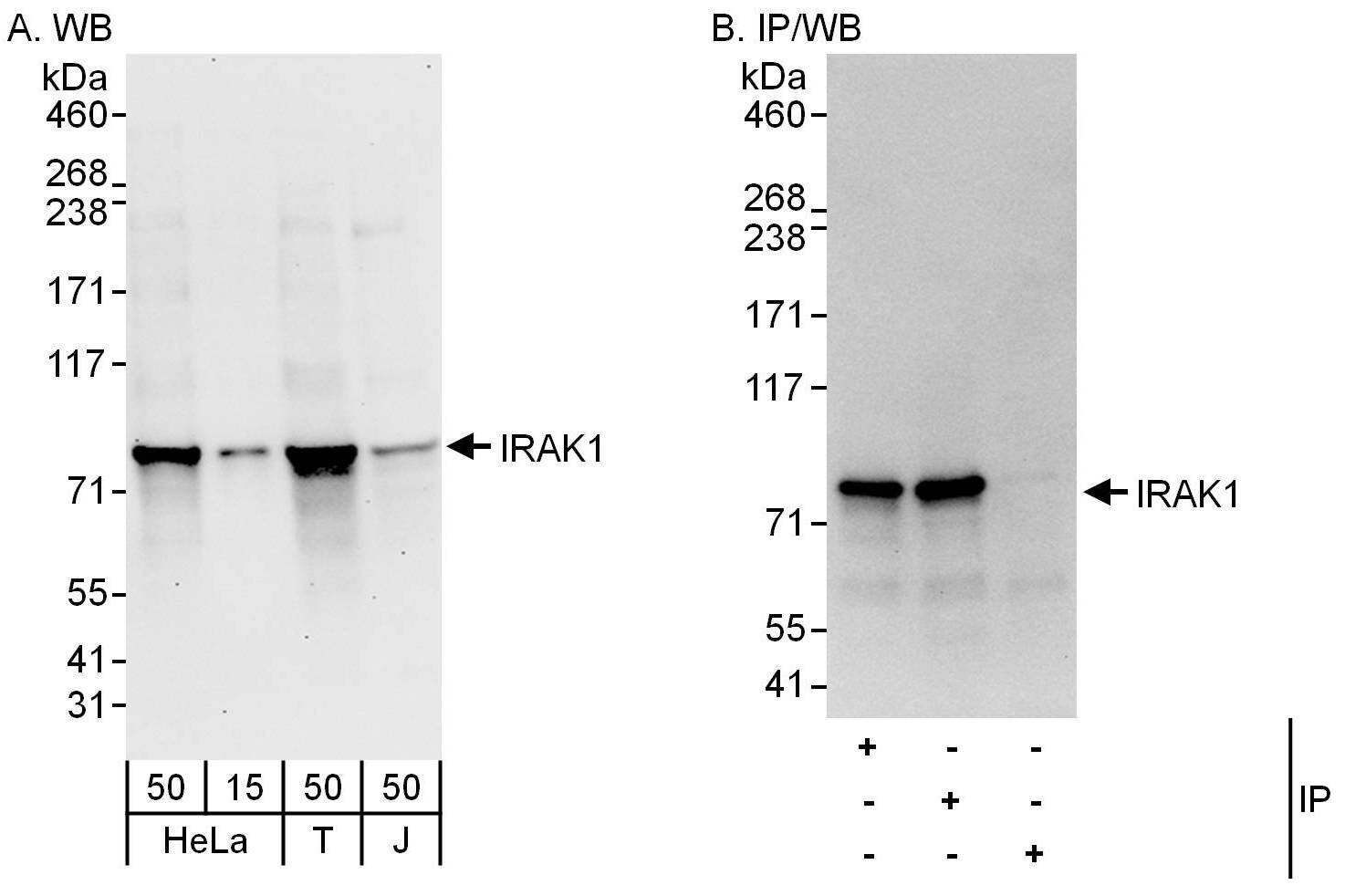 IRAK1 Antibody