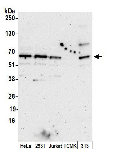 SDCCAG10 Antibody