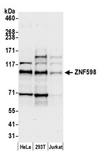 ZNF598 Antibody