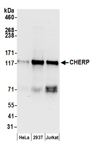 CHERP Antibody