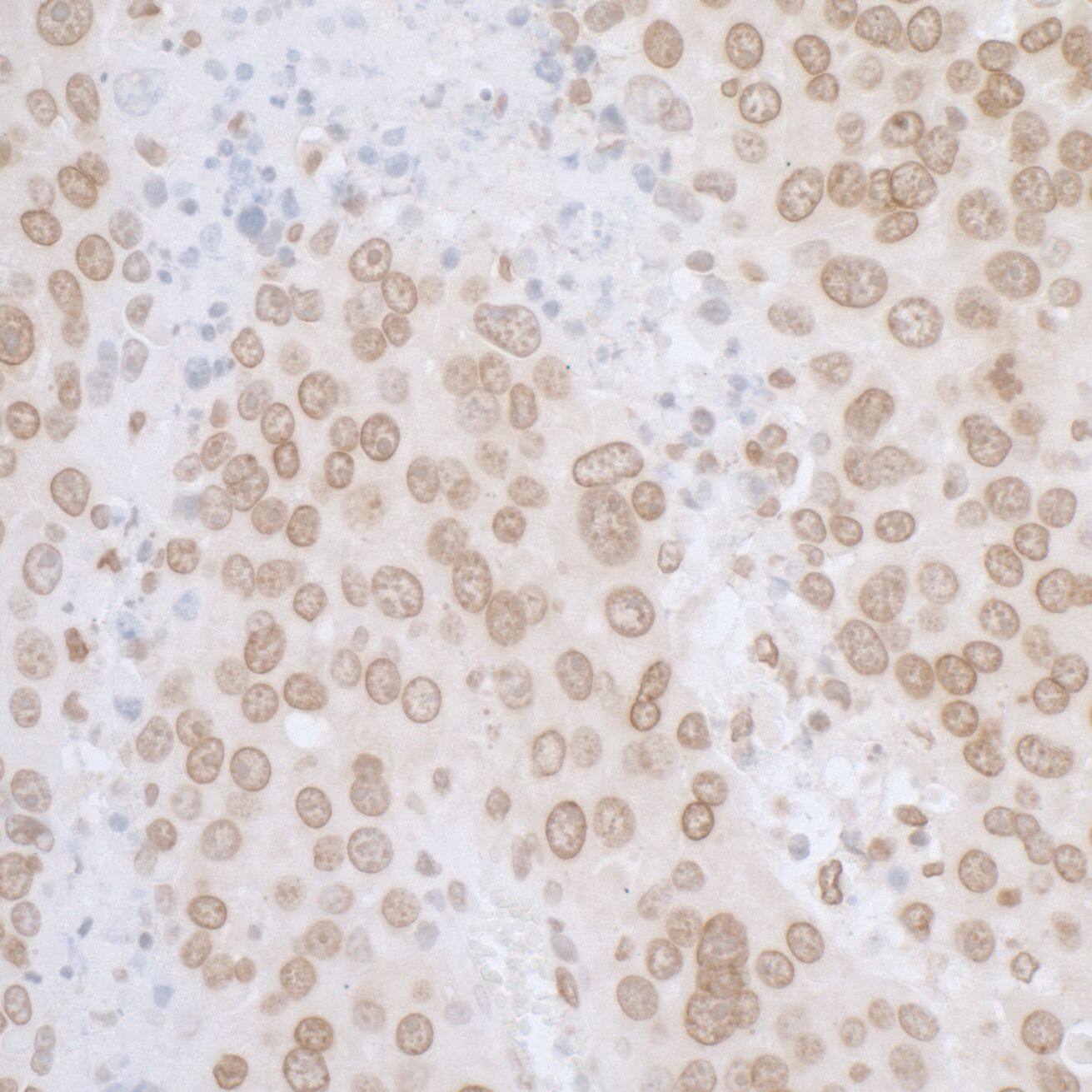 Thymopoietin/LAP2 Antibody