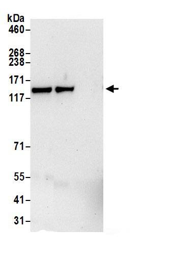 DIAPH3 Antibody