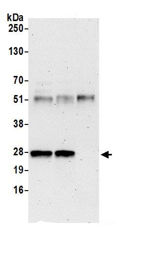 RPL10A Antibody