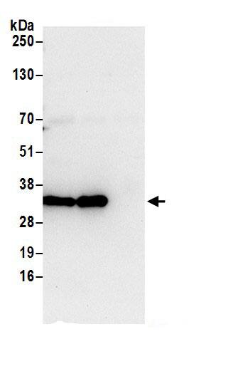 HPRT Antibody