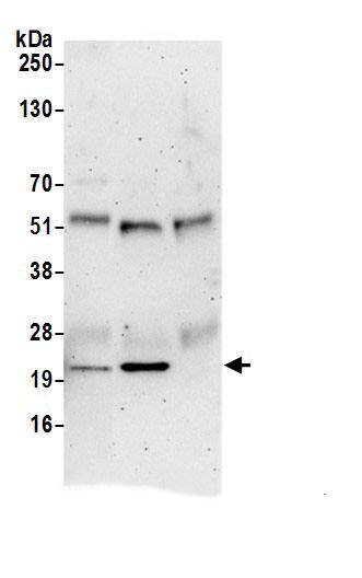 Tmp21/p23 Antibody