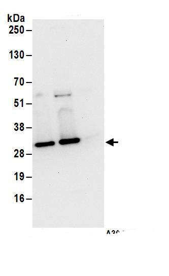 UBE2S Antibody