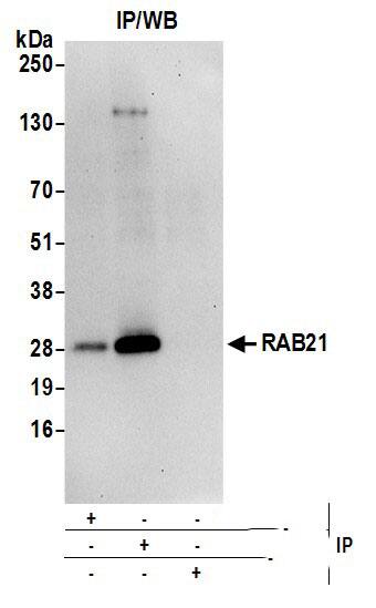 RAB21 Antibody