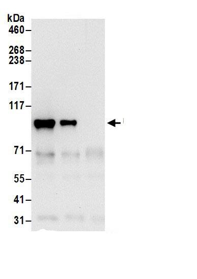 Beta 2 Adaptin Antibody