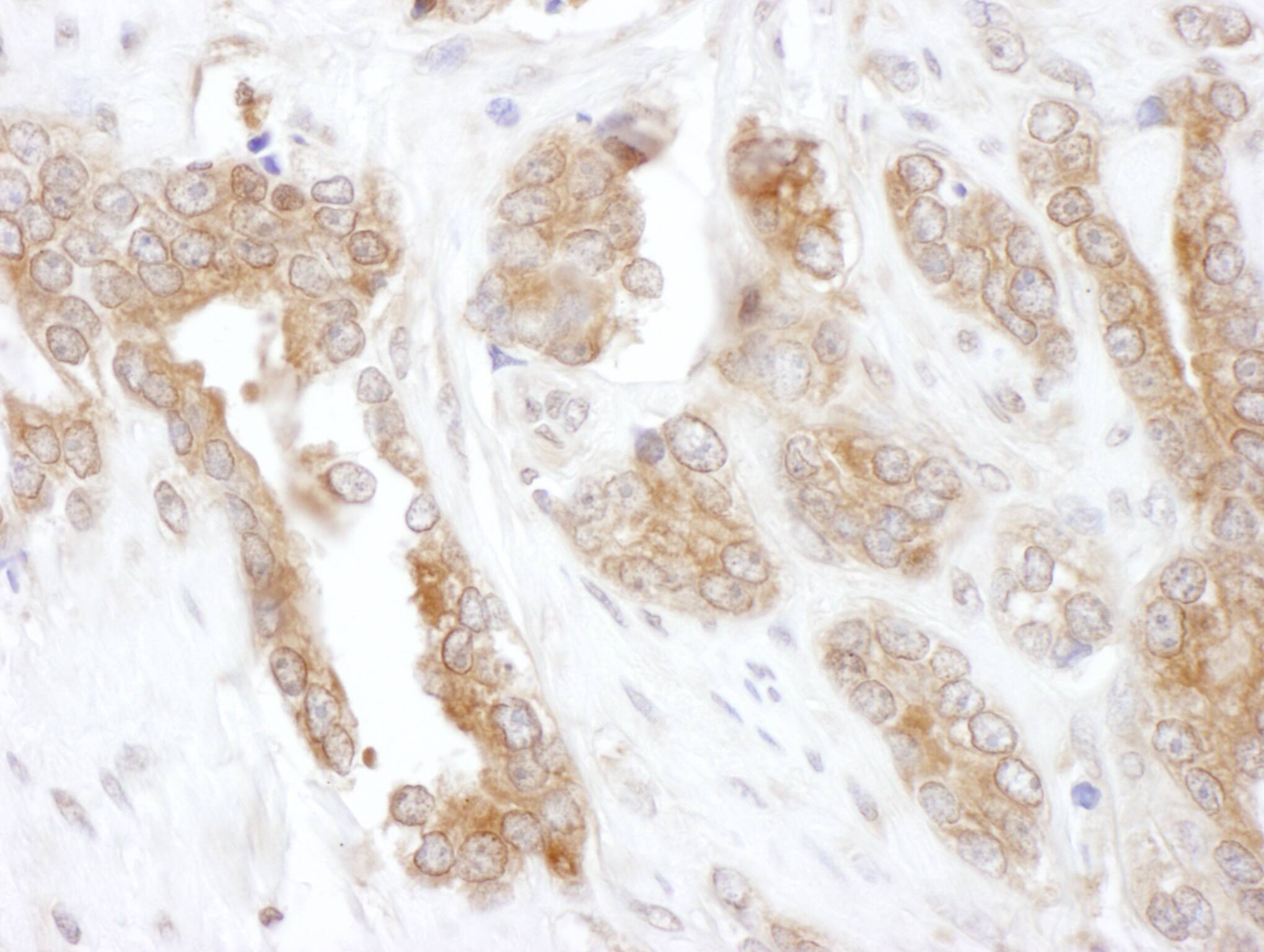 CCT5 Antibody