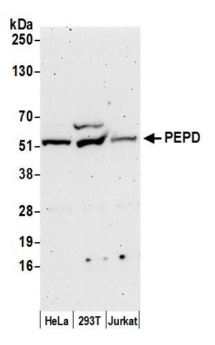 PEPD Antibody