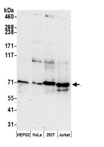 Acetyl CoA synthetase Antibody