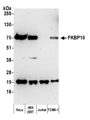 FKBP10 Antibody