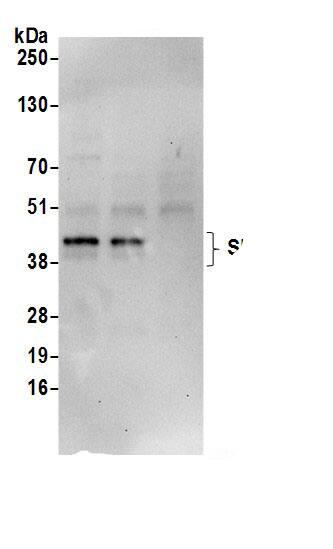 SNURPORTIN1 Antibody