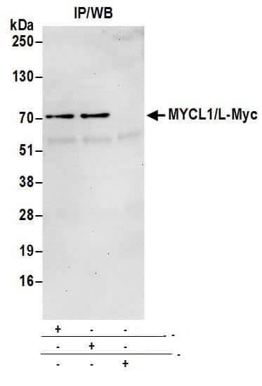 MYCL1/L-Myc Antibody