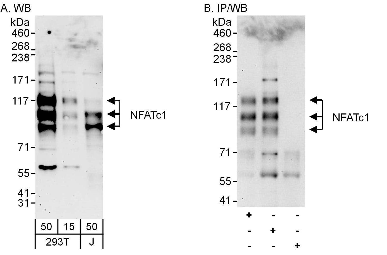 NFATC1/NFAT2 Antibody