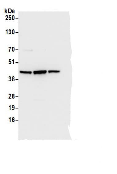 Adenosine Deaminase/ADA Antibody