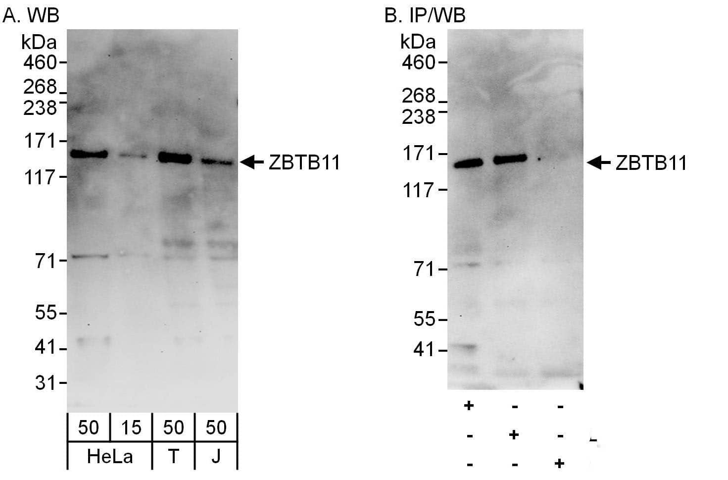 ZBTB11 Antibody