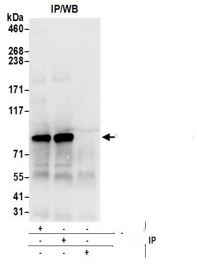 ALDH18A1 Antibody