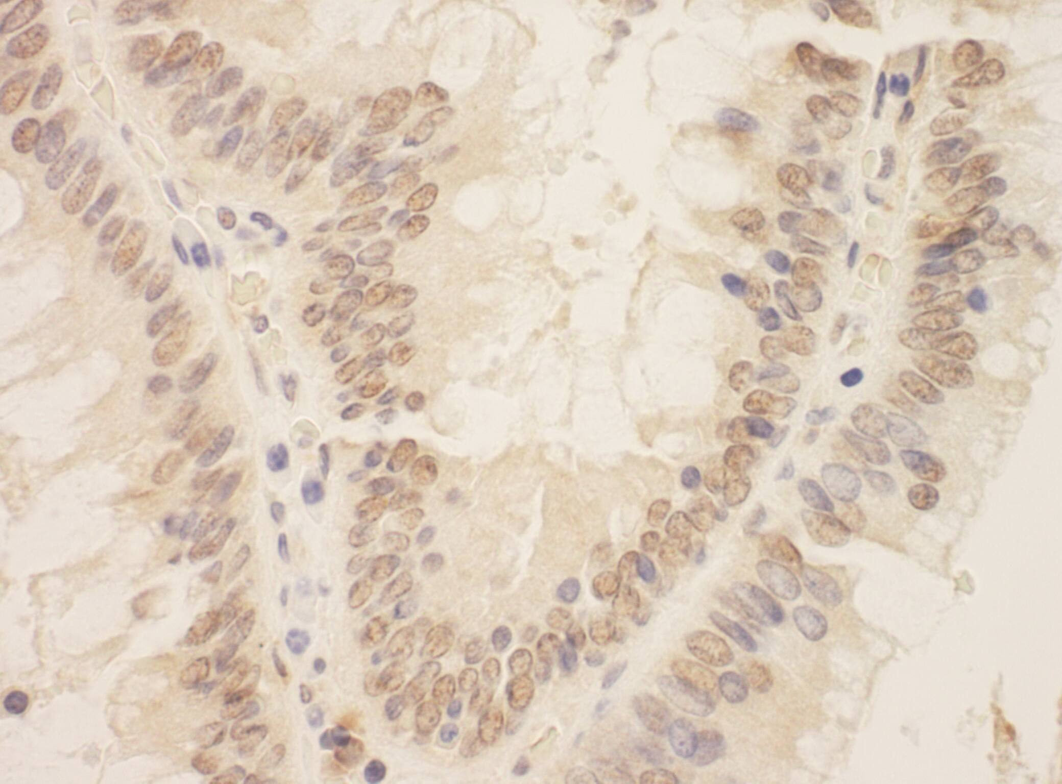 ZEB2 Antibody