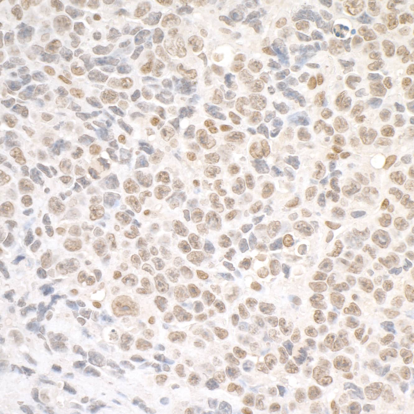 SMC1 Antibody