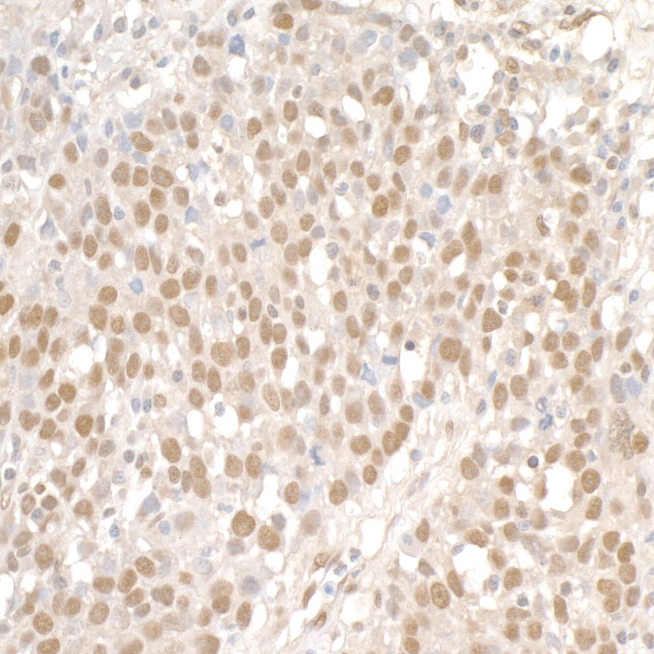 SMC1 Antibody
