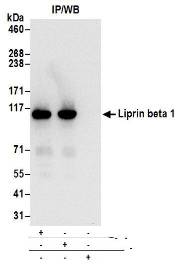 PPFIBP1 Antibody