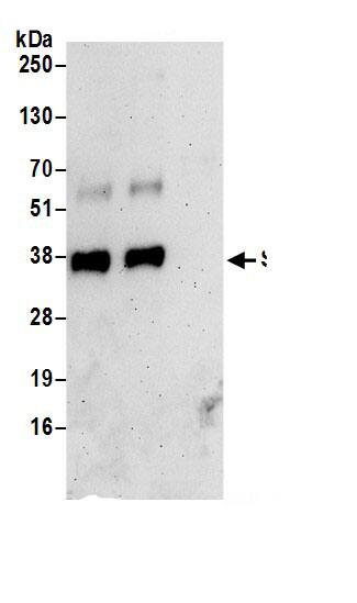 SURF2 Antibody