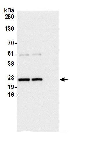 Glyoxalase I Antibody