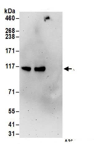 UBE3C Antibody