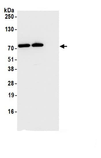 CCDC22 Antibody