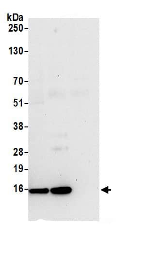 TBCA Antibody