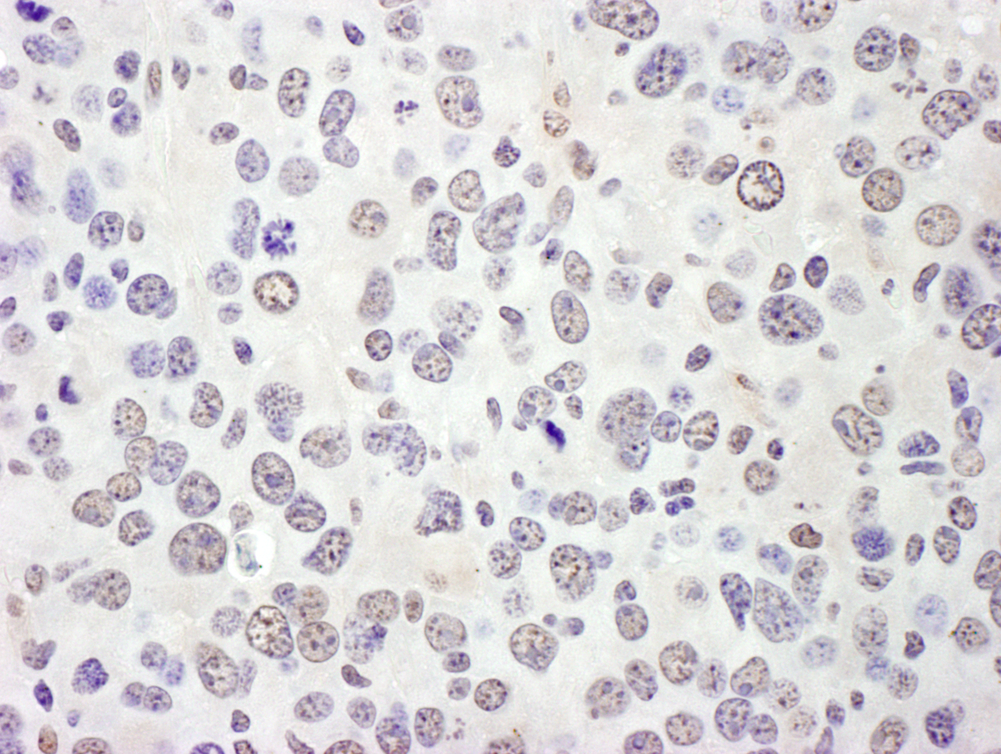 EIF4A3 Antibody