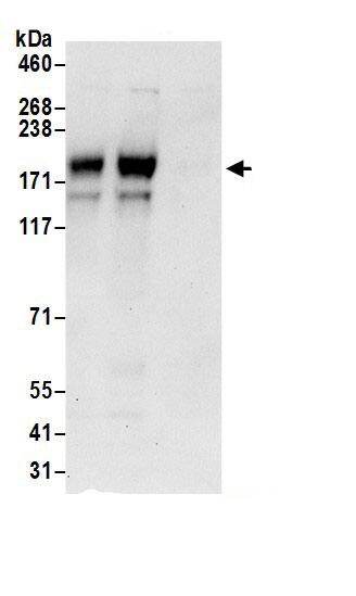 Adenylate Cyclase 9 Antibody