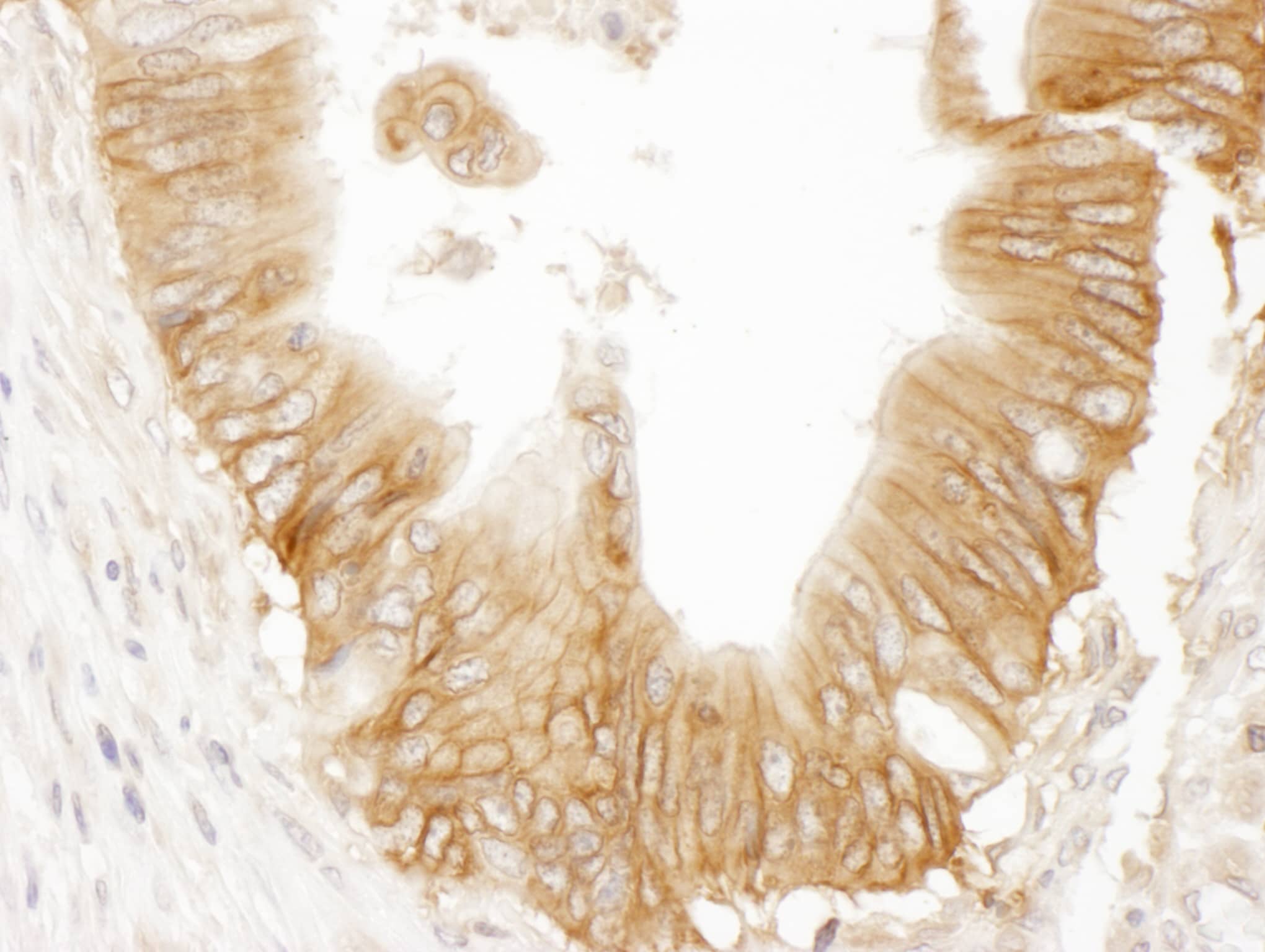 Adenylate Cyclase 9 Antibody