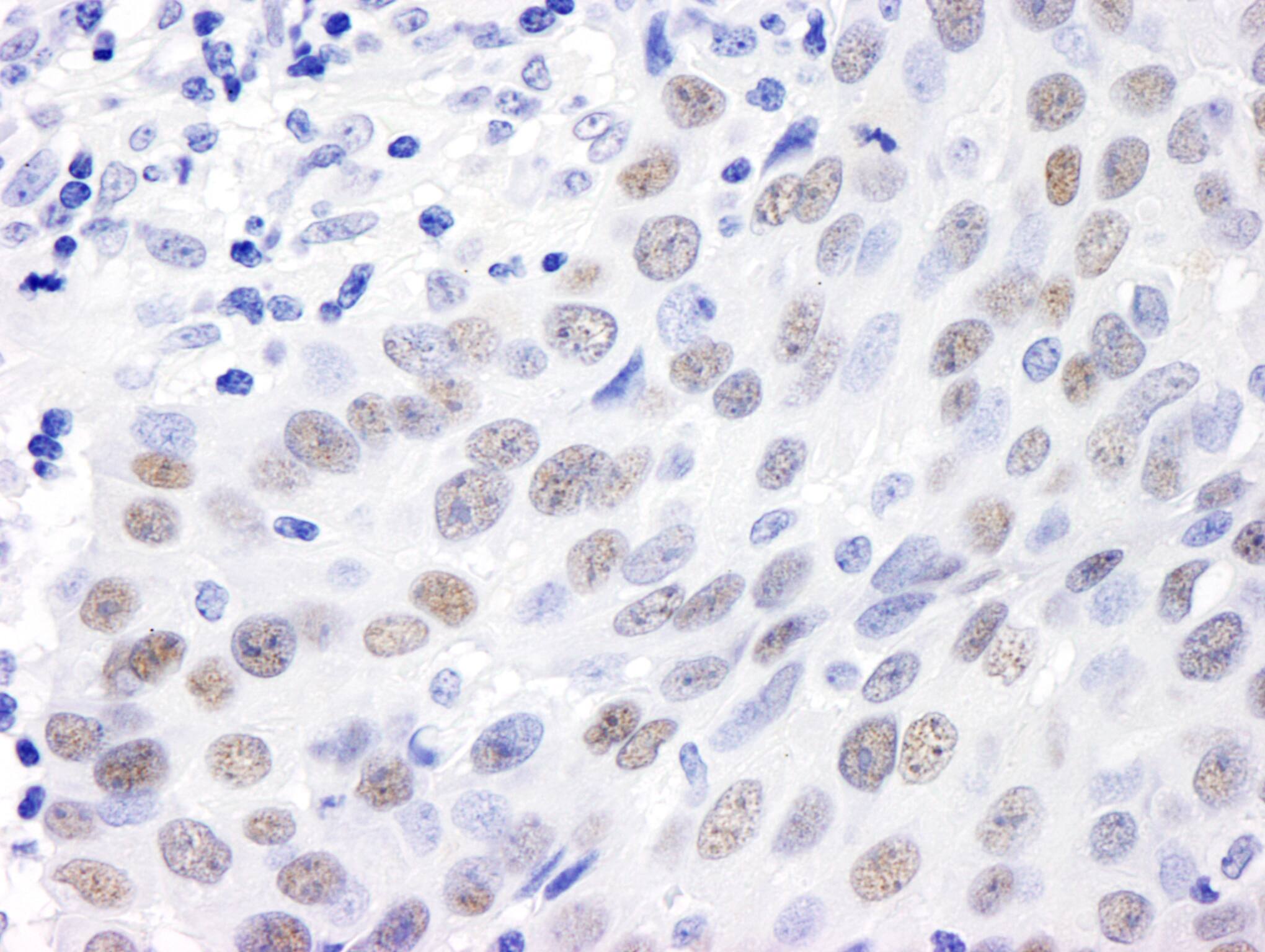 MDC1 Antibody