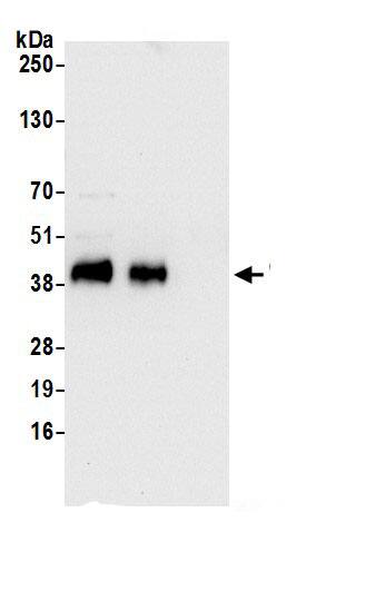 Ribonuclease Inhibitor Antibody