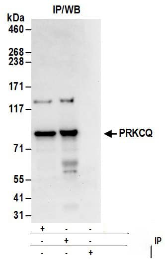 PKC theta Antibody