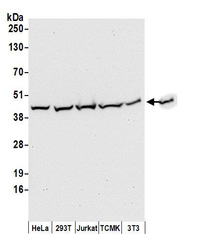 Aldolase A Antibody