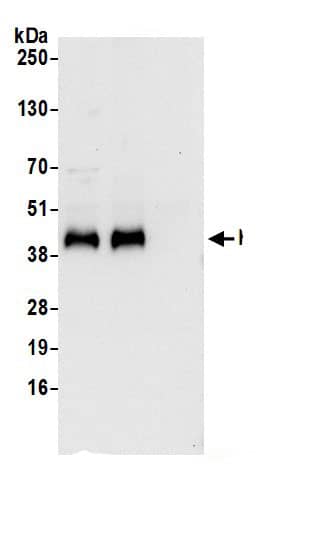 Ribonuclease Inhibitor Antibody