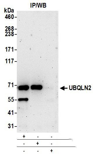 Ubiquilin 2 Antibody
