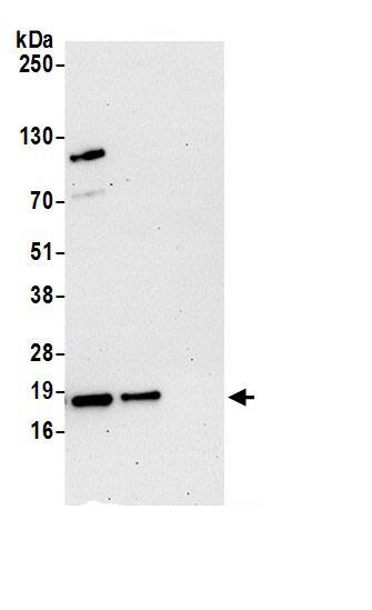 ARPC4 Antibody